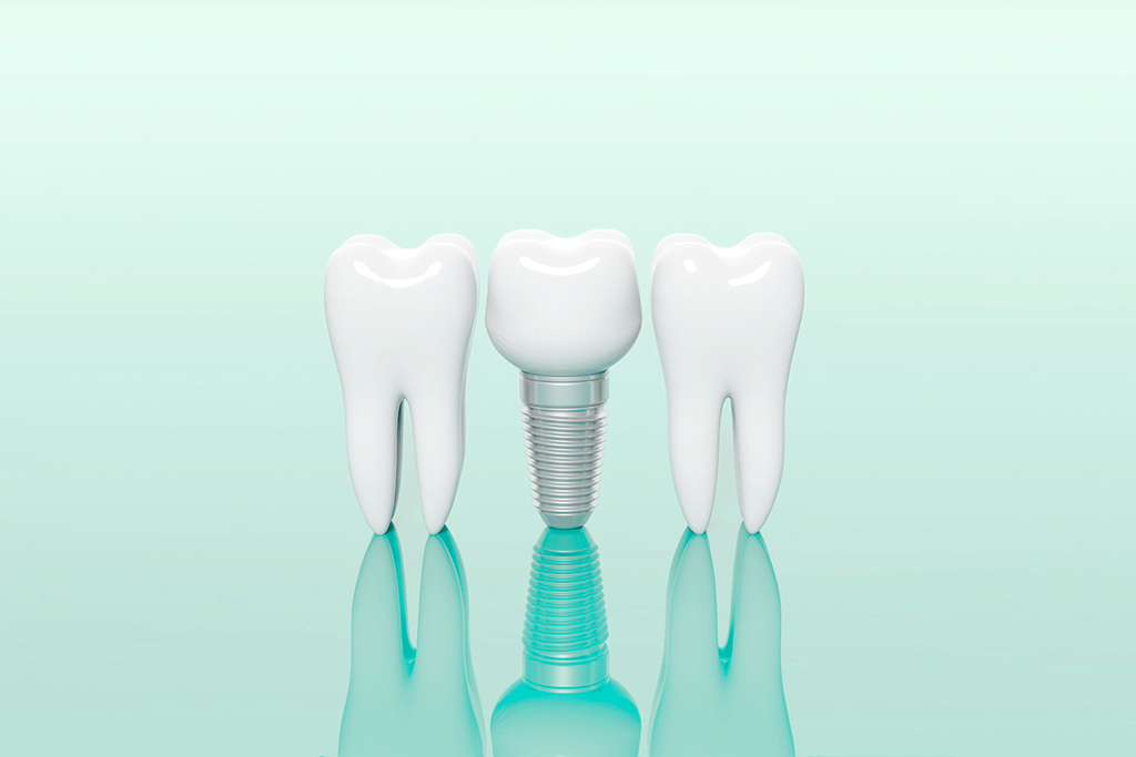 福岡県糟屋郡新宮町・新宮おがわ歯科 おとな・こども歯科